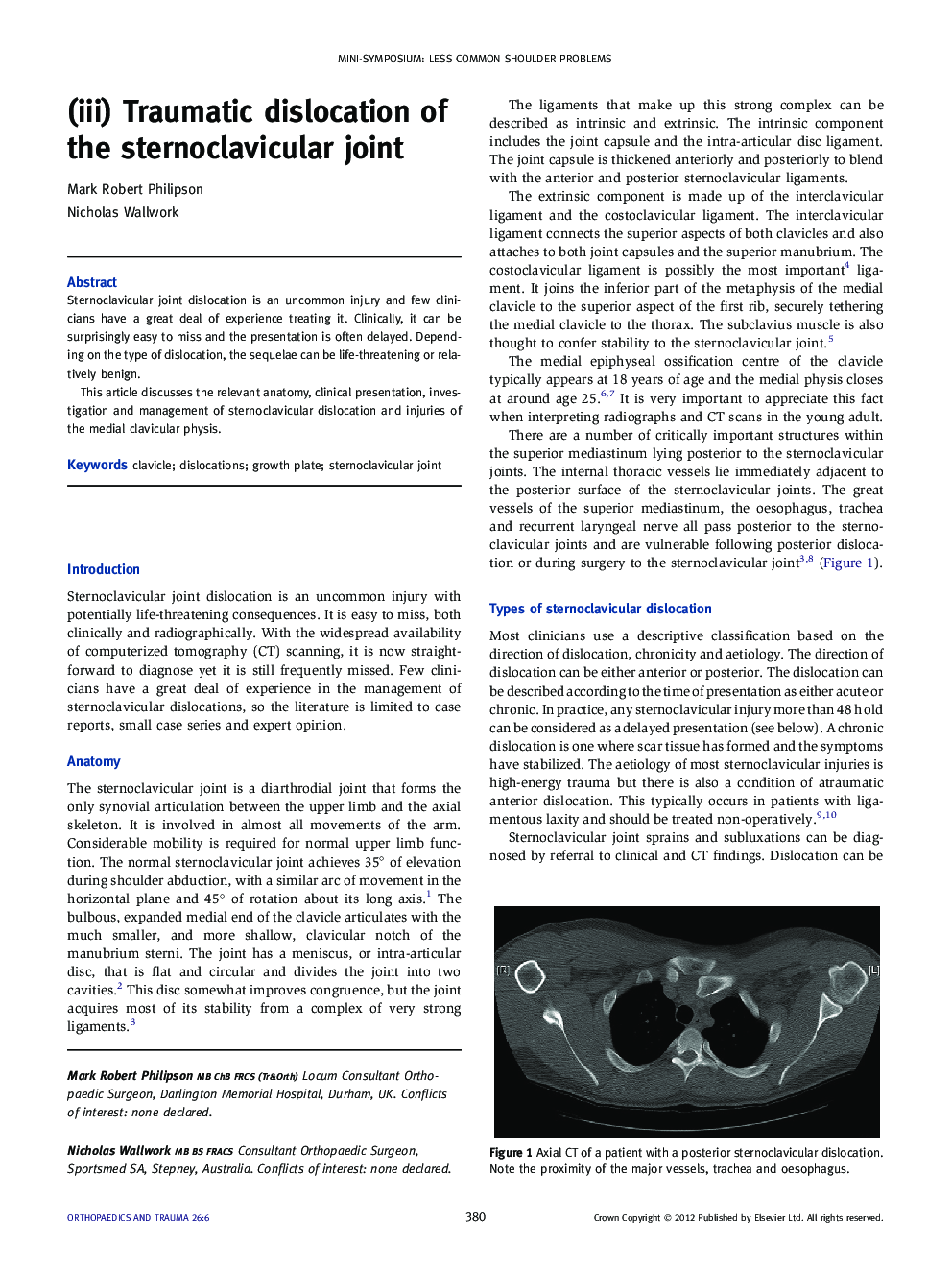 (iii) Traumatic dislocation of the sternoclavicular joint