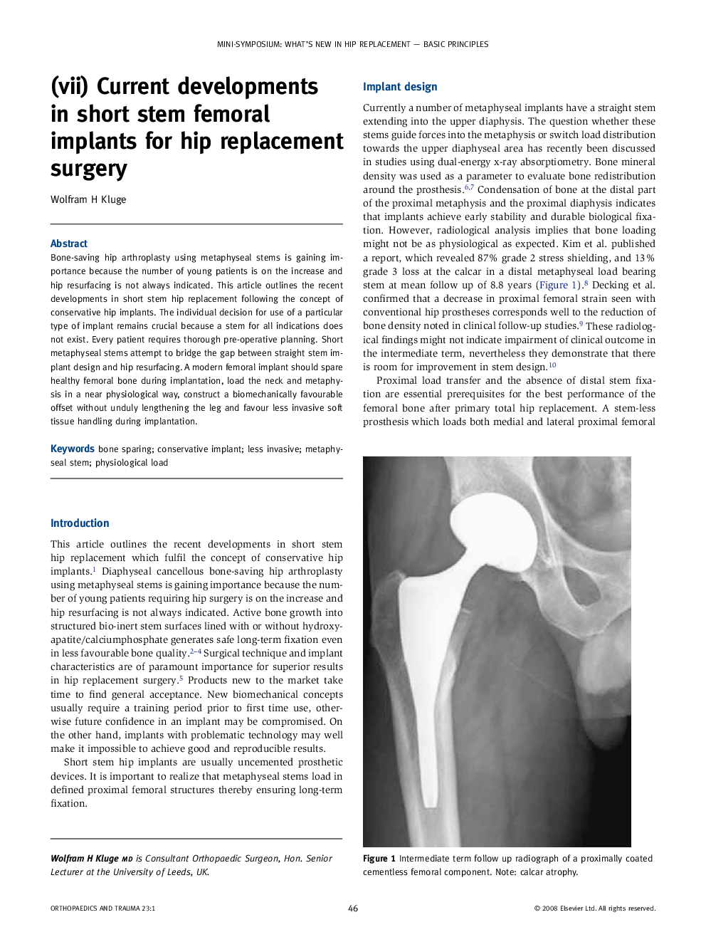 (vii) Current developments in short stem femoral implants for hip replacement surgery