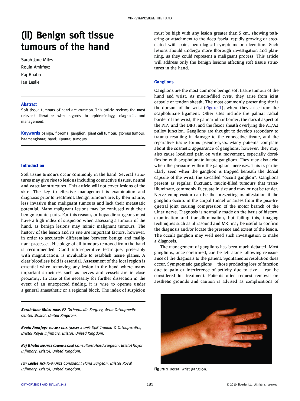 (ii) Benign soft tissue tumours of the hand