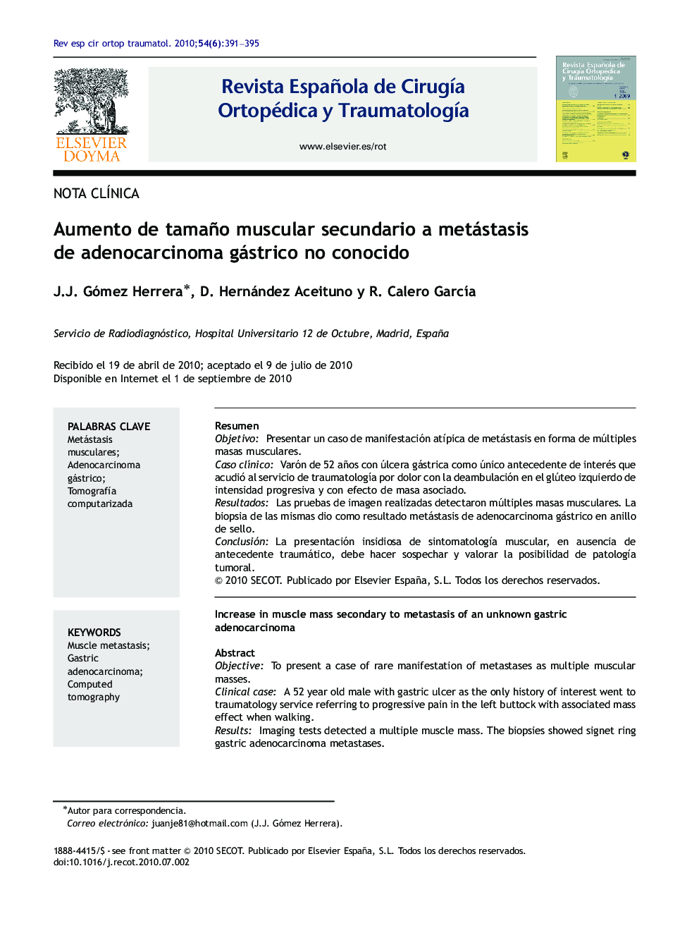 Aumento de tamaño muscular secundario a metástasis de adenocarcinoma gástrico no conocido