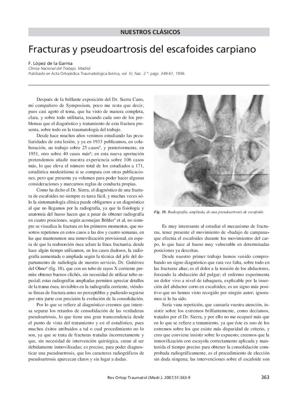 Fracturas y pseudoartrosis del escafoides carpiano