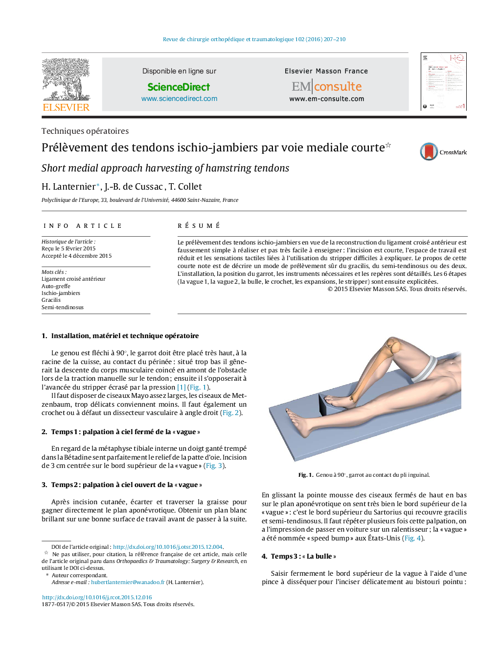 Prélèvement des tendons ischio-jambiers par voie mediale courte 