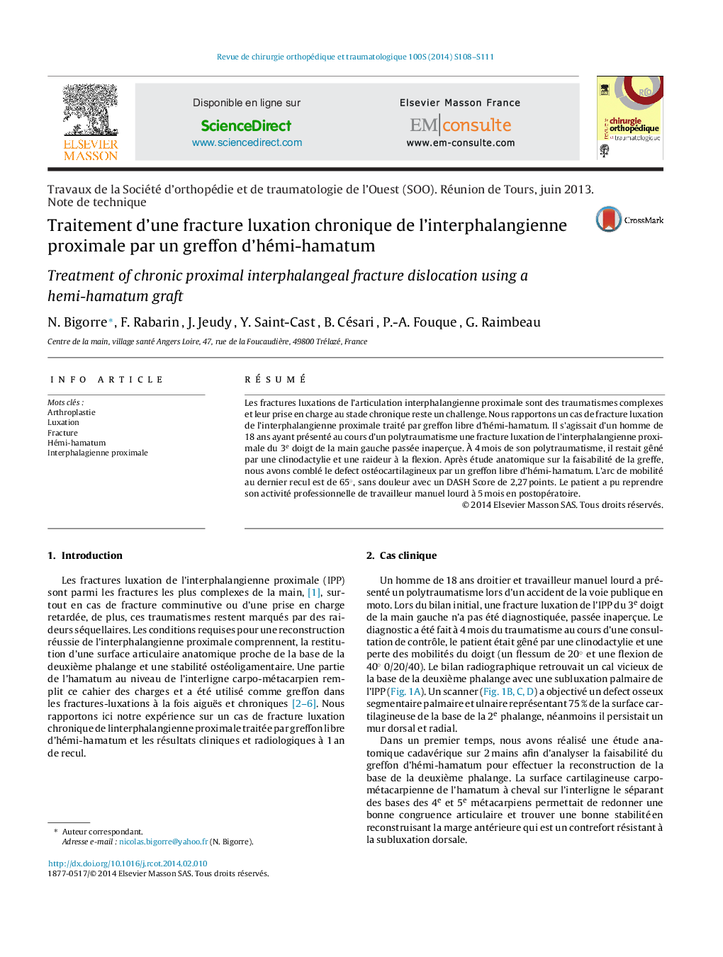 Traitement d’une fracture luxation chronique de l’interphalangienne proximale par un greffon d’hémi-hamatum