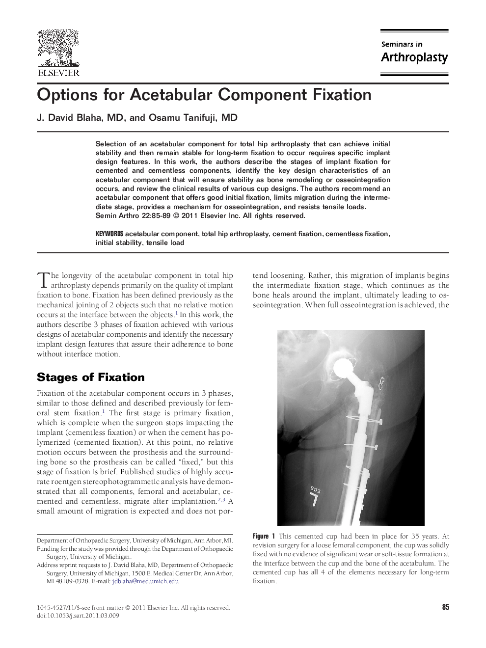 Options for Acetabular Component Fixation 