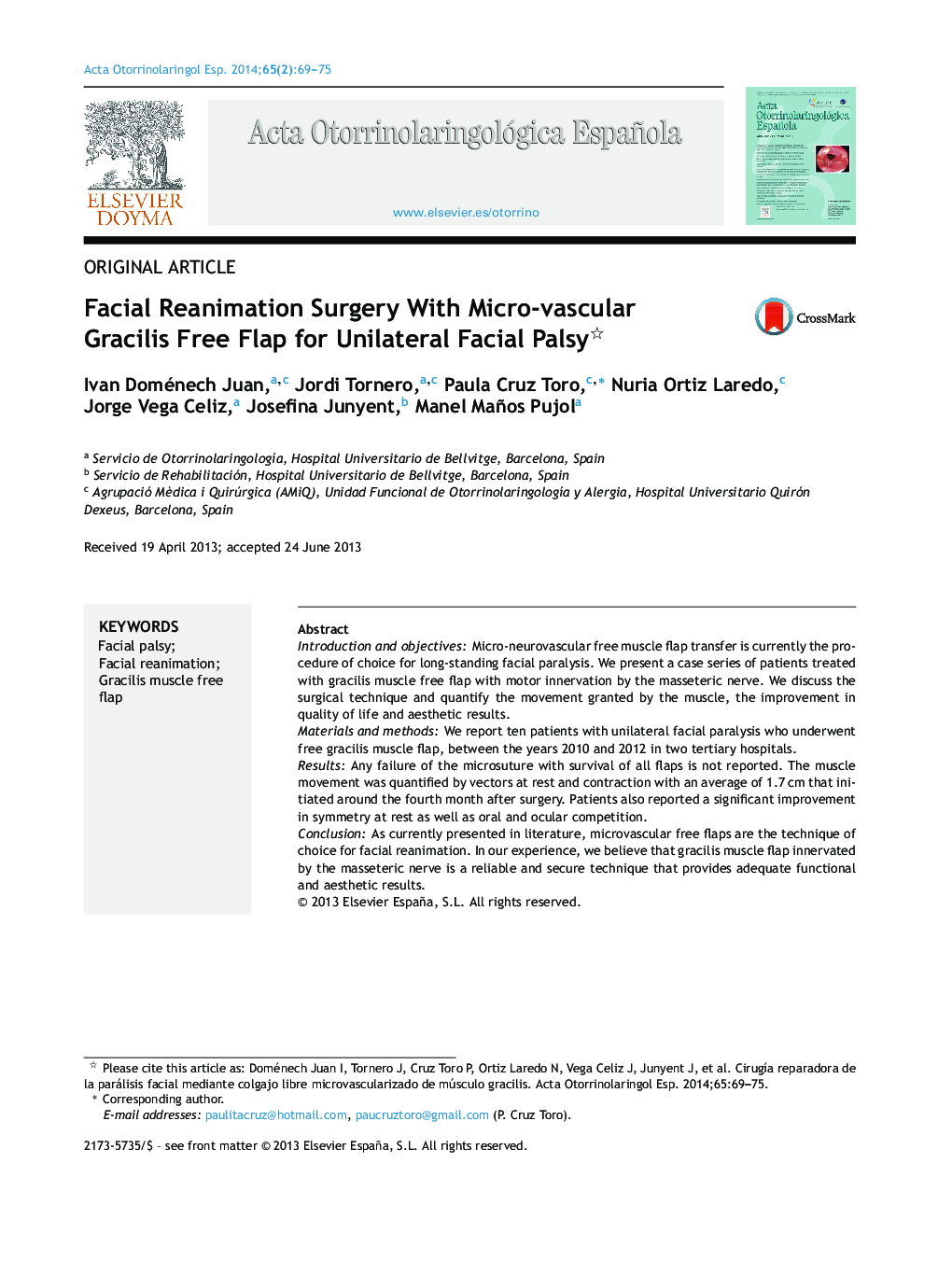 Facial Reanimation Surgery With Micro-vascular Gracilis Free Flap for Unilateral Facial Palsy 