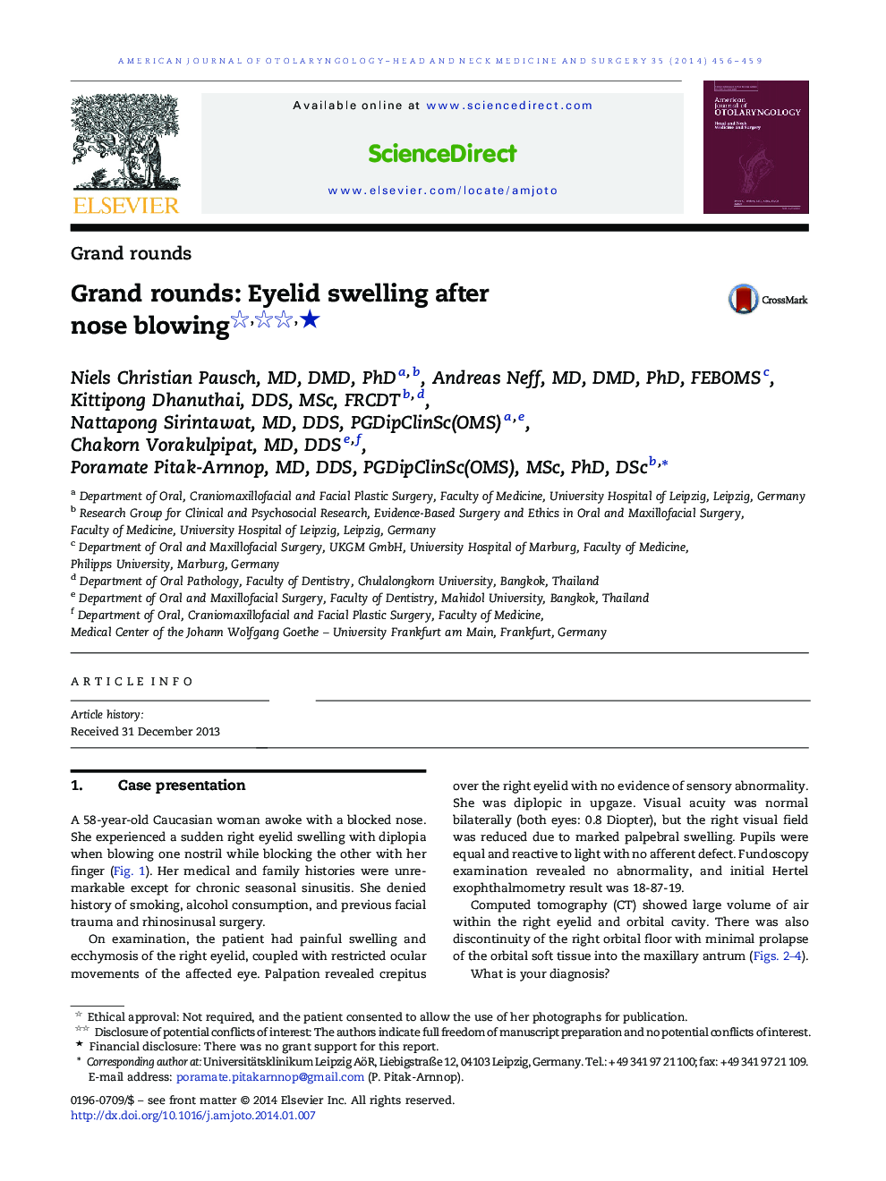 Grand rounds: Eyelid swelling after nose blowing