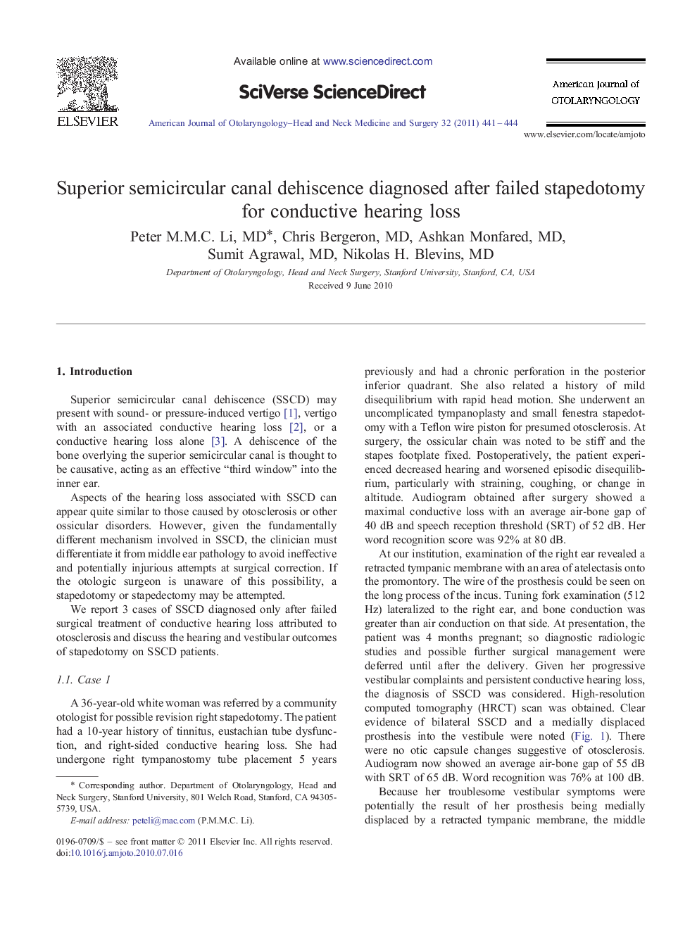 Superior semicircular canal dehiscence diagnosed after failed stapedotomy for conductive hearing loss