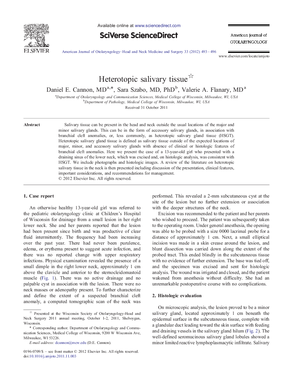 Heterotopic salivary tissue 