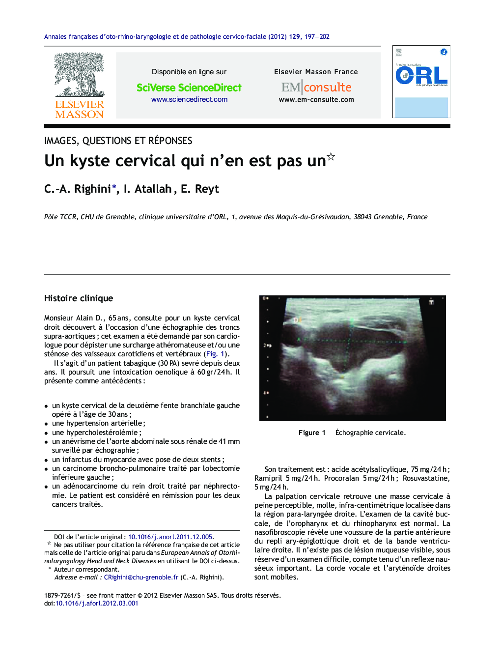 Un kyste cervical qui n'en est pas un