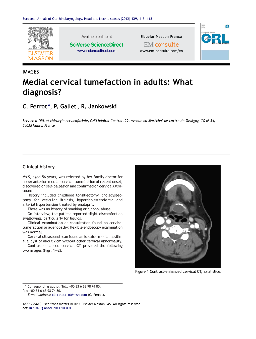 Medial cervical tumefaction in adults: What diagnosis?