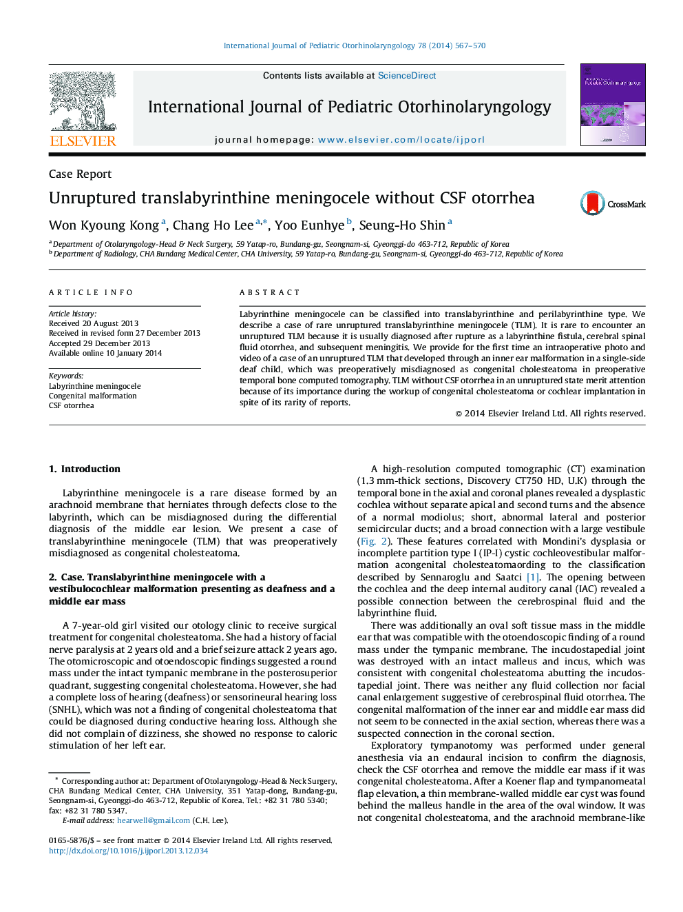 Unruptured translabyrinthine meningocele without CSF otorrhea