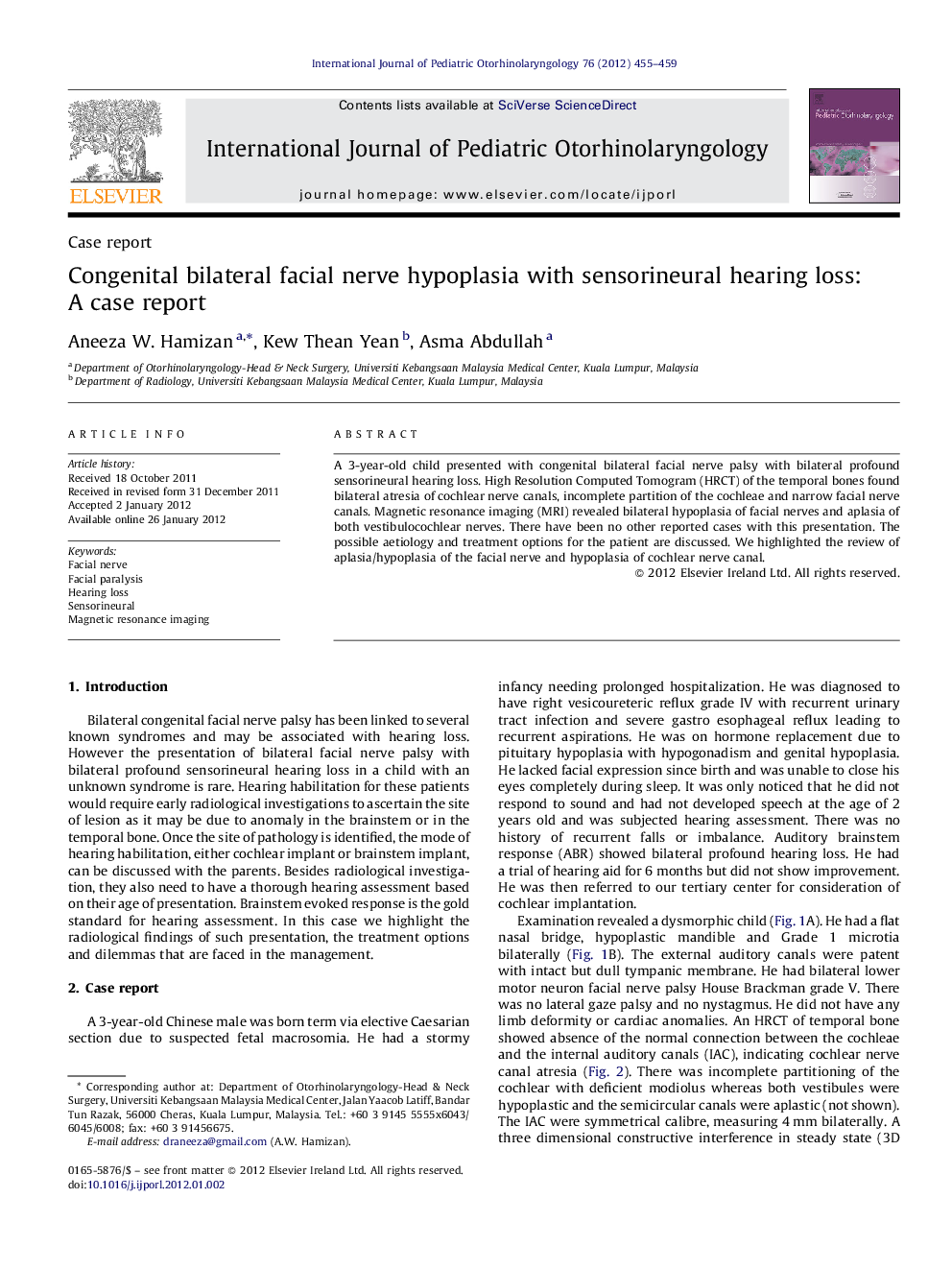 Congenital bilateral facial nerve hypoplasia with sensorineural hearing loss: A case report