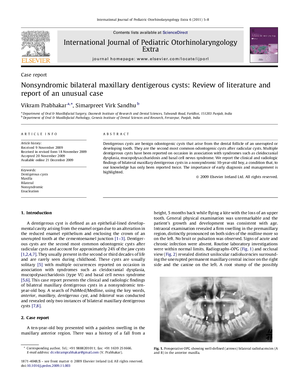 Nonsyndromic bilateral maxillary dentigerous cysts: Review of literature and report of an unusual case