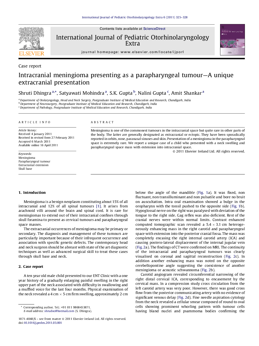 Intracranial meningioma presenting as a parapharyngeal tumour—A unique extracranial presentation