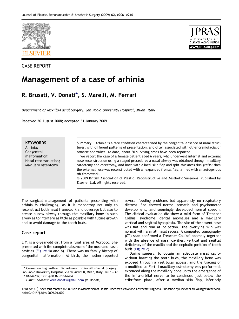 Management of a case of arhinia