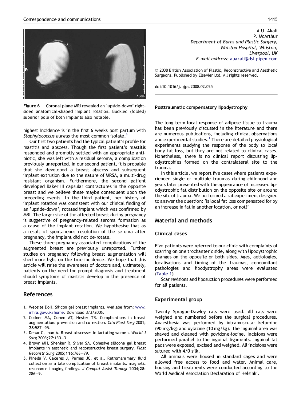 Posttraumatic compensatory lipodystrophy