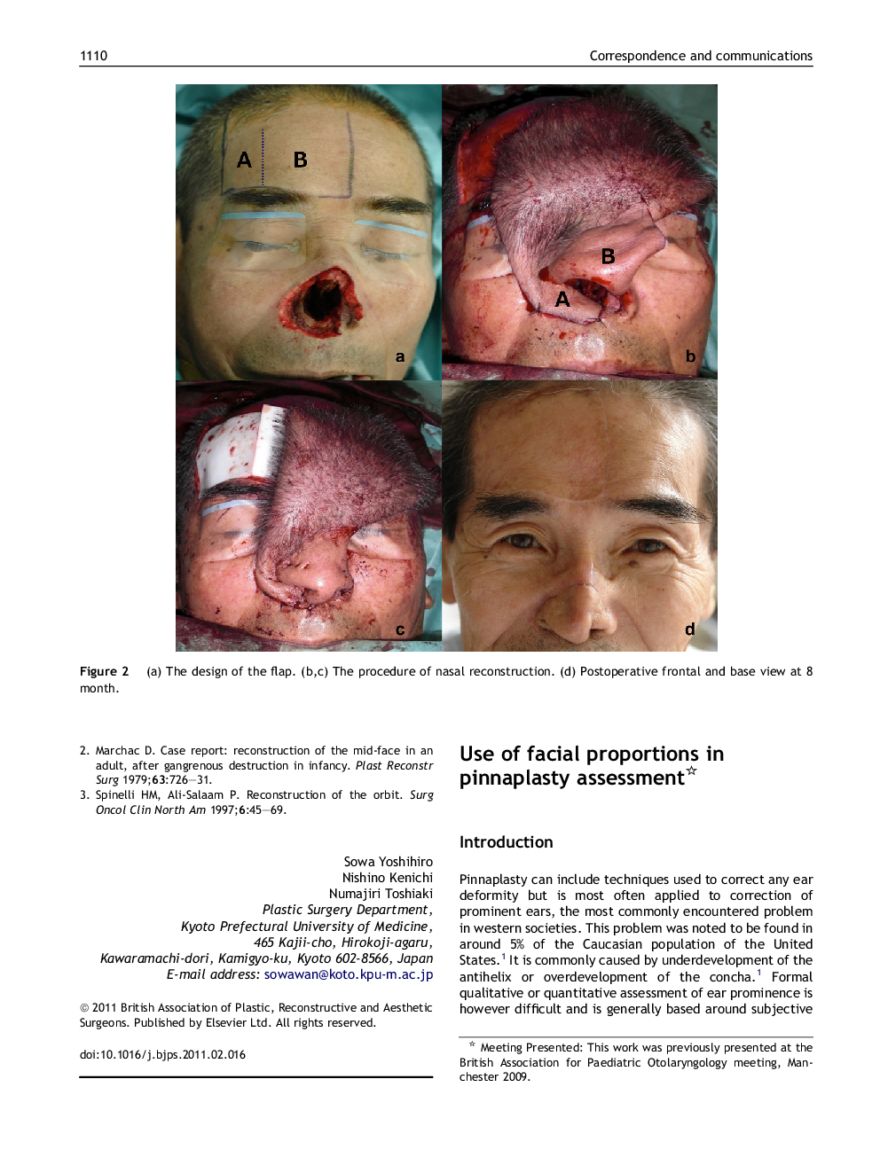 Use of facial proportions in pinnaplasty assessment