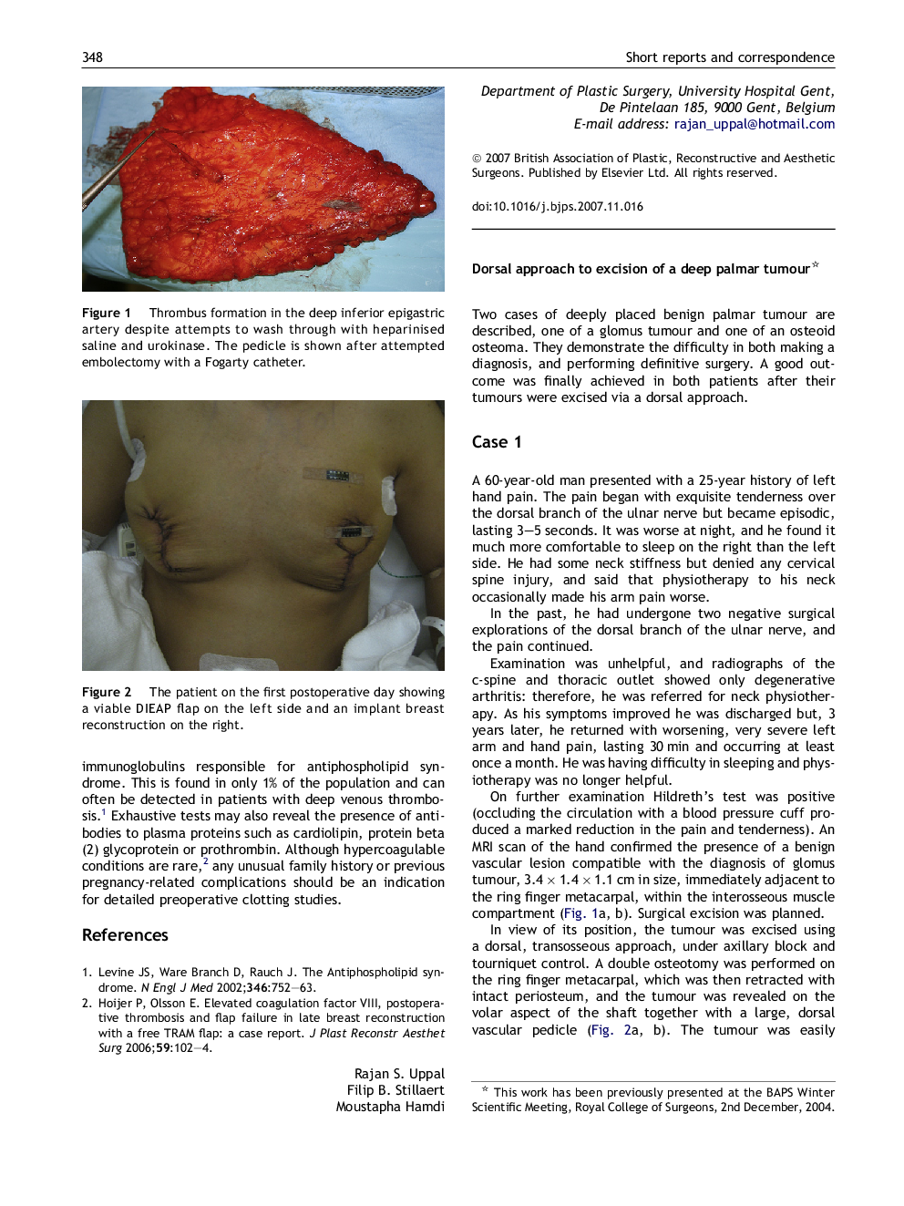 Dorsal approach to excision of a deep palmar tumour