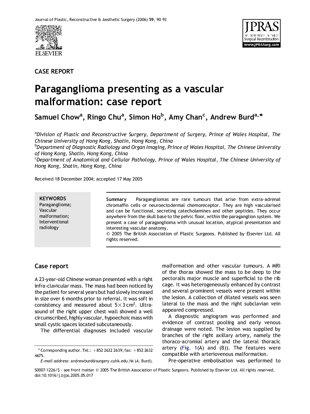 Paraganglioma presenting as a vascular malformation: case report