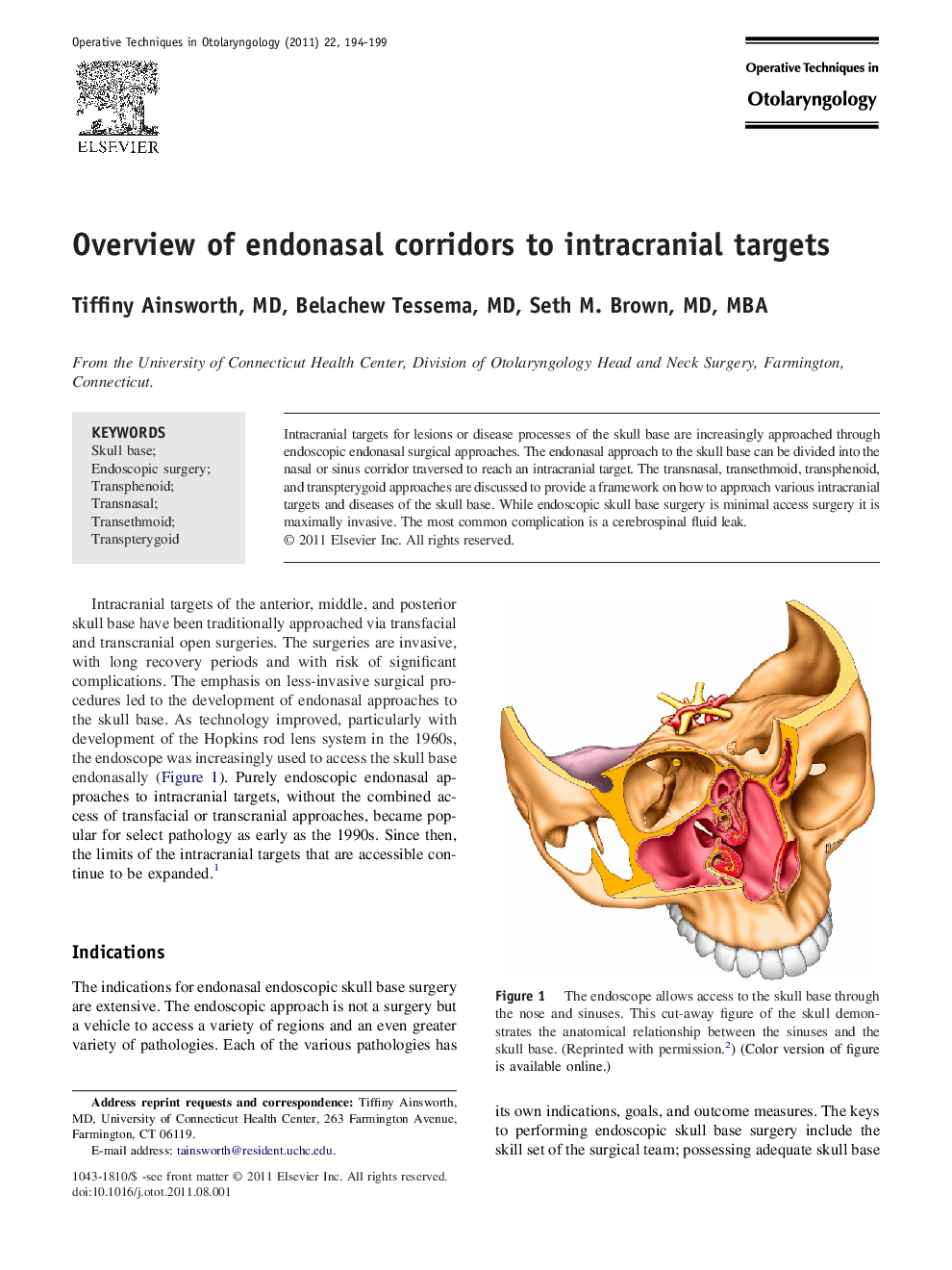 Overview of endonasal corridors to intracranial targets