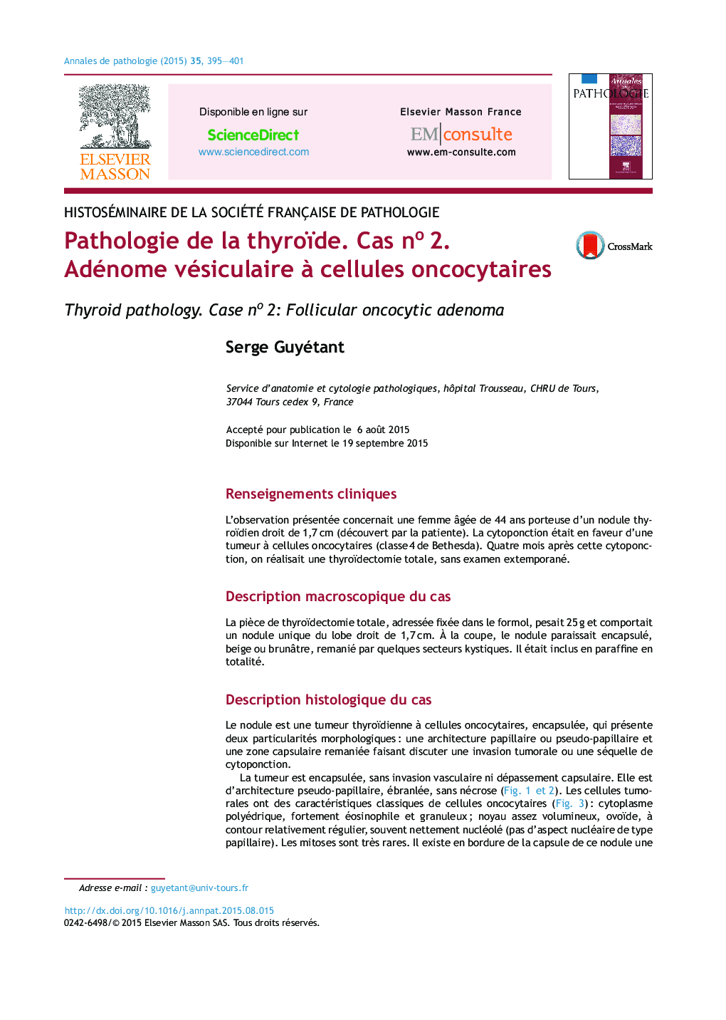 Pathologie de la thyroïde. Cas noÂ 2. Adénome vésiculaire Ã  cellules oncocytaires