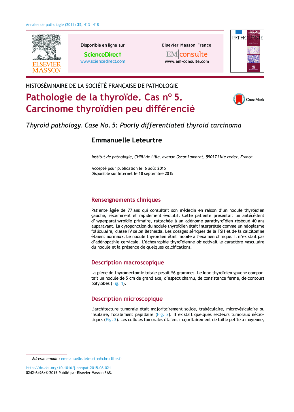 Pathologie de la thyroïde. Cas noÂ 5. Carcinome thyroïdien peu différencié