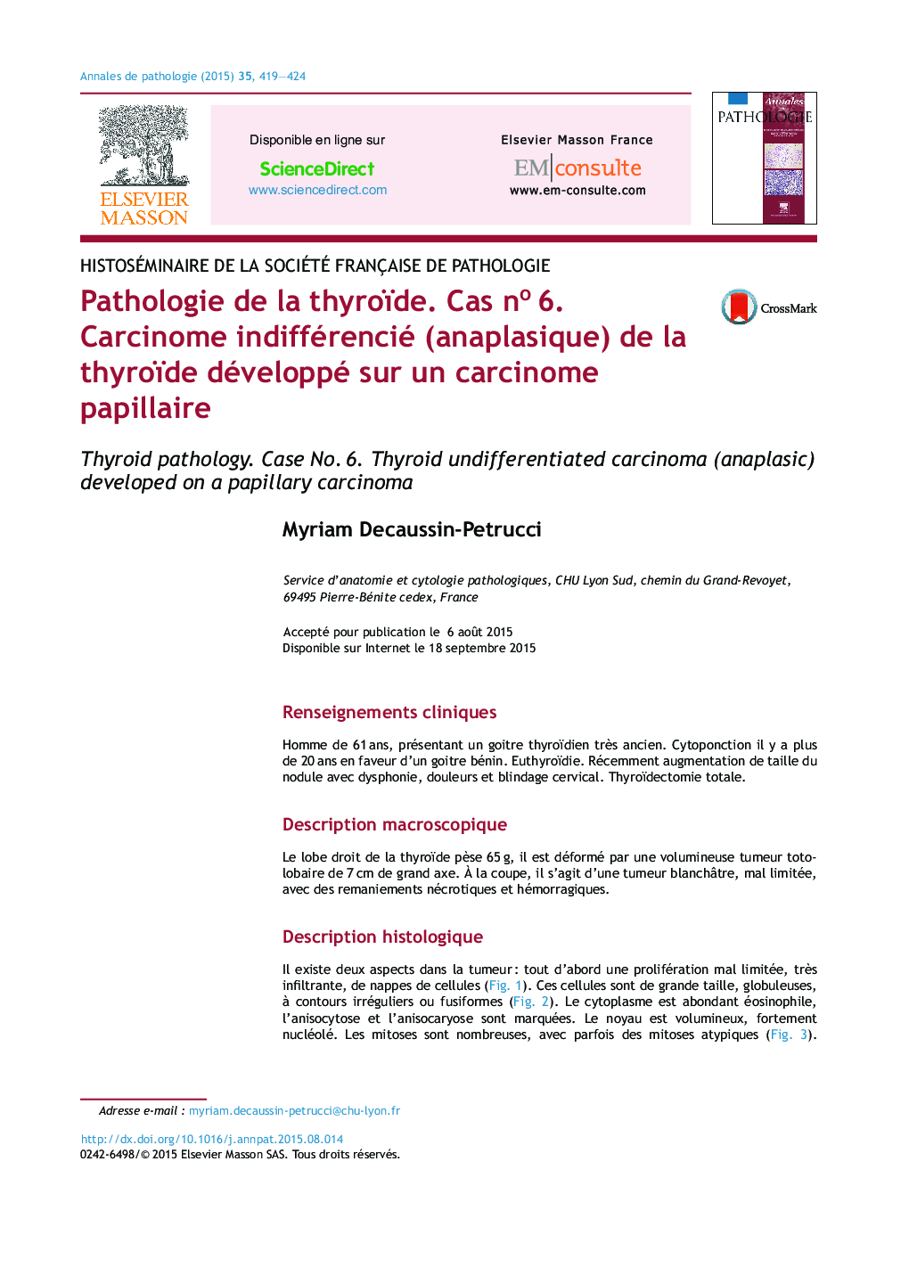 Pathologie de la thyroïde. Cas noÂ 6. Carcinome indifférencié (anaplasique) de la thyroïde développé sur un carcinome papillaire