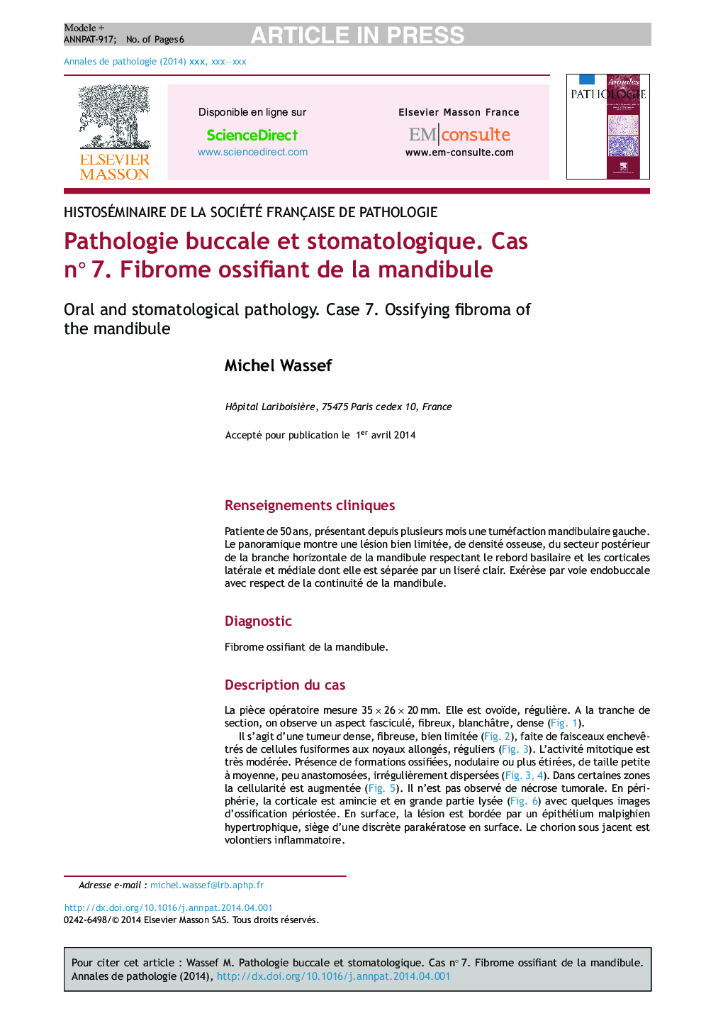 Pathologie buccale et stomatologique. Cas nÂ°Â 7. Fibrome ossifiant de la mandibule