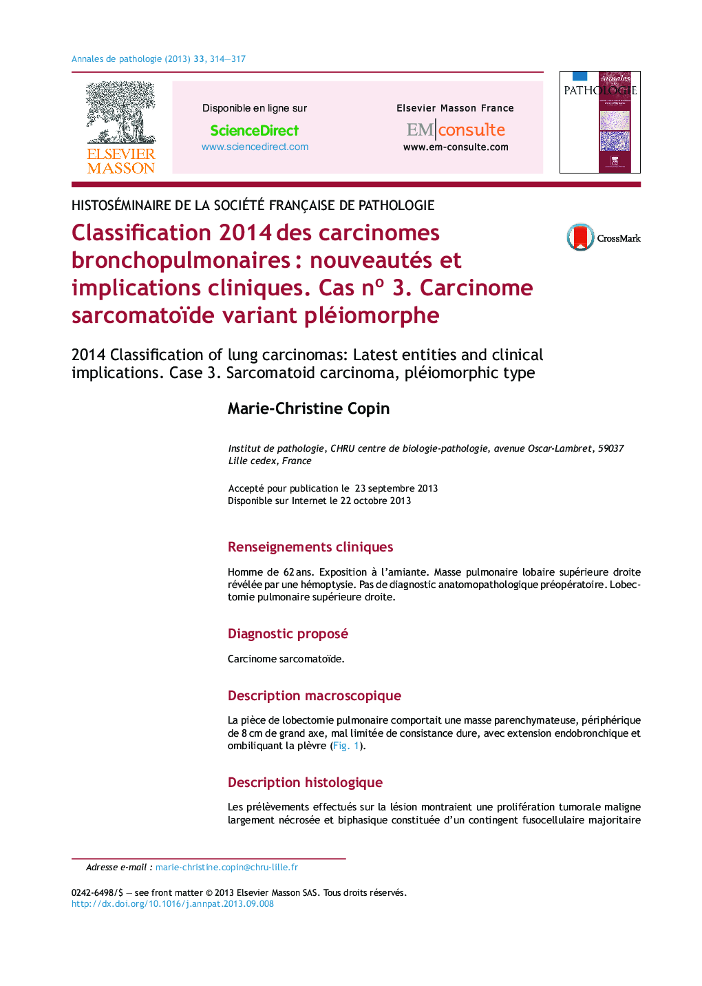 Classification 2014Â des carcinomes bronchopulmonairesÂ : nouveautés et implications cliniques. Cas no 3. Carcinome sarcomatoïde variant pléiomorphe