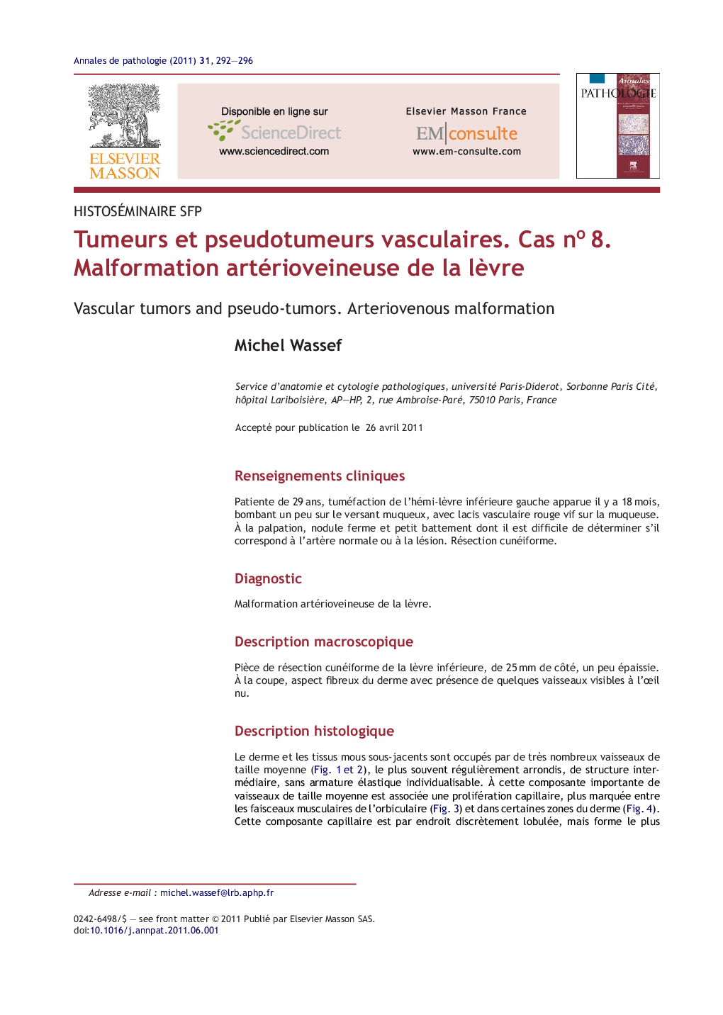 Tumeurs et pseudotumeurs vasculaires. Cas noÂ 8. Malformation artérioveineuse de la lÃ¨vre