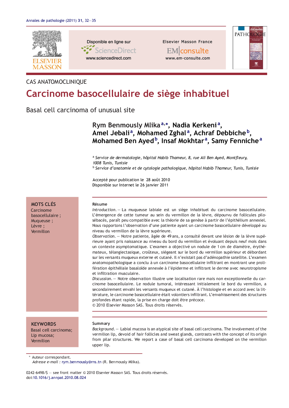 Carcinome basocellulaire de siÃ¨ge inhabituel