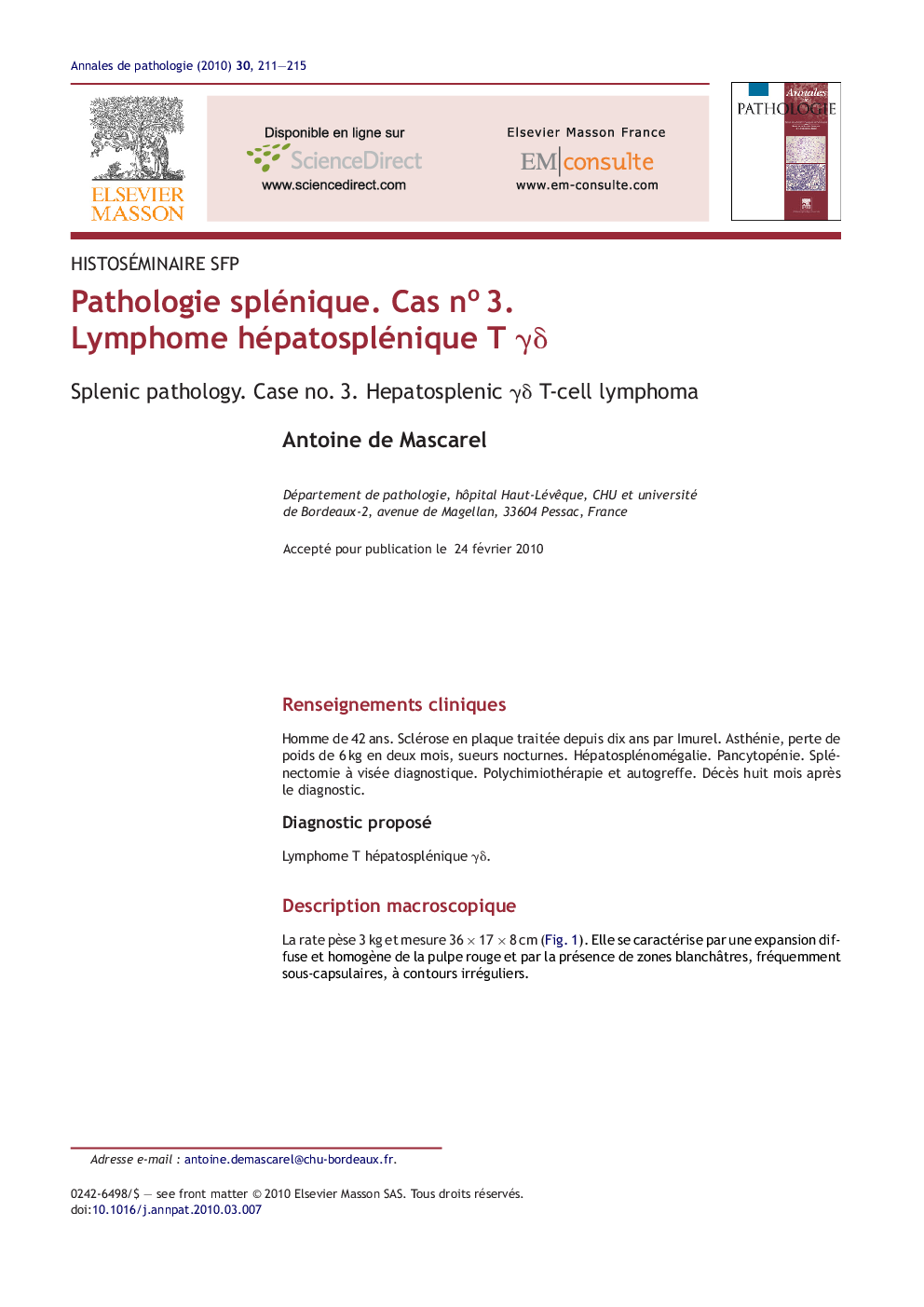 Pathologie splénique. Cas noÂ 3. Lymphome hépatosplénique T Î³Î´