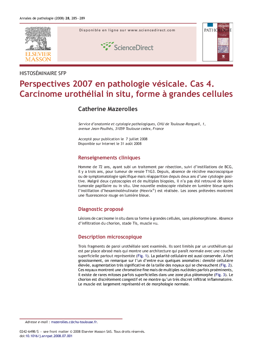 Perspectives 2007 en pathologie vésicale. Cas 4