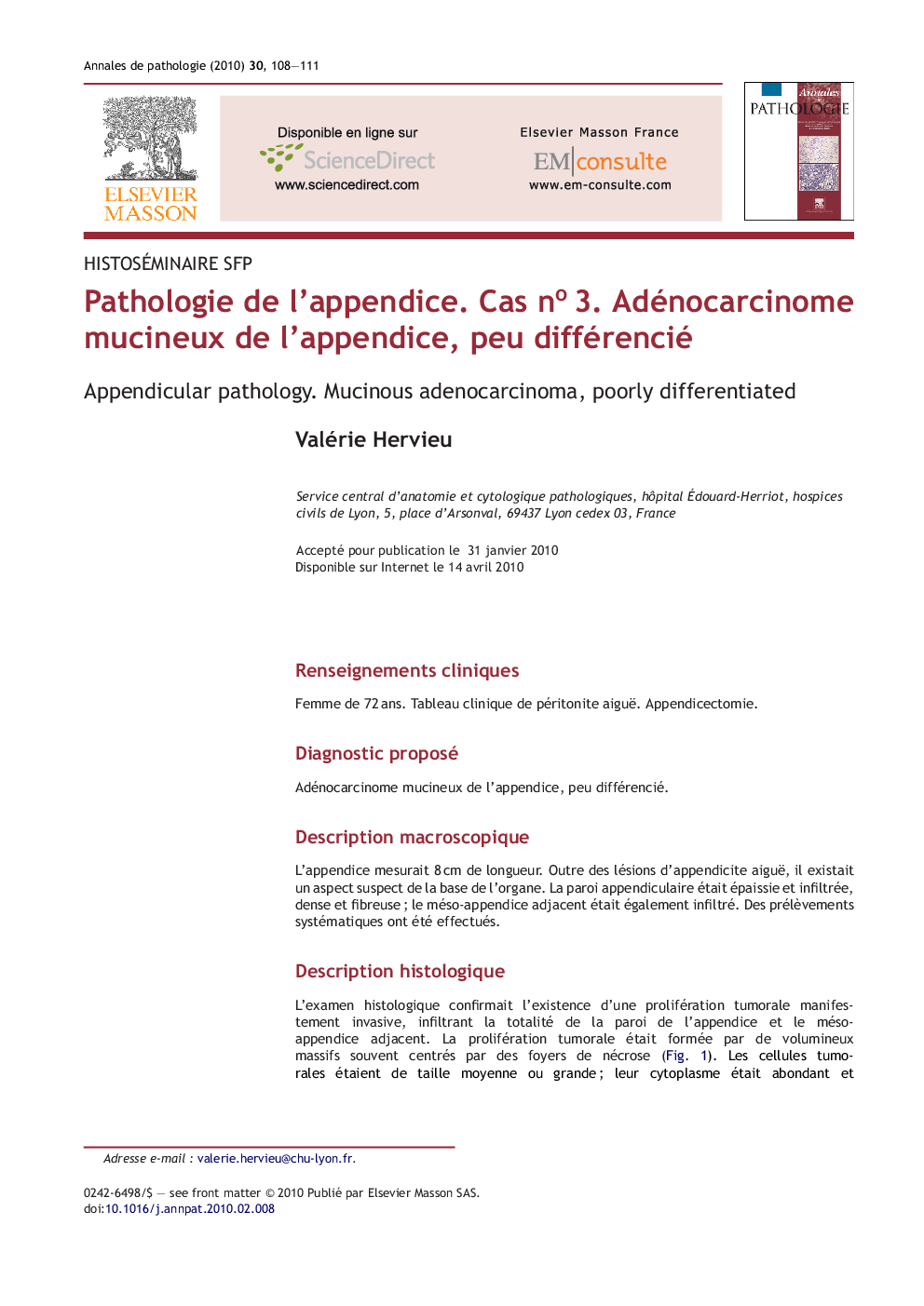 Pathologie de l'appendice. Cas noÂ 3. Adénocarcinome mucineux de l'appendice, peu différencié