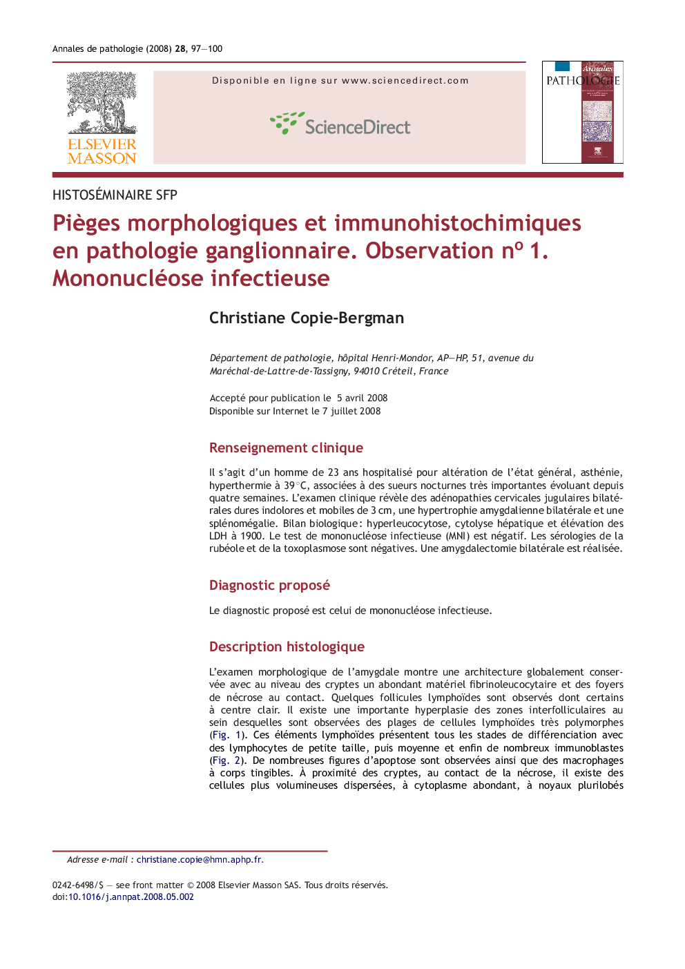 PiÃ¨ges morphologiques et immunohistochimiques en pathologie ganglionnaire. Observation noÂ 1