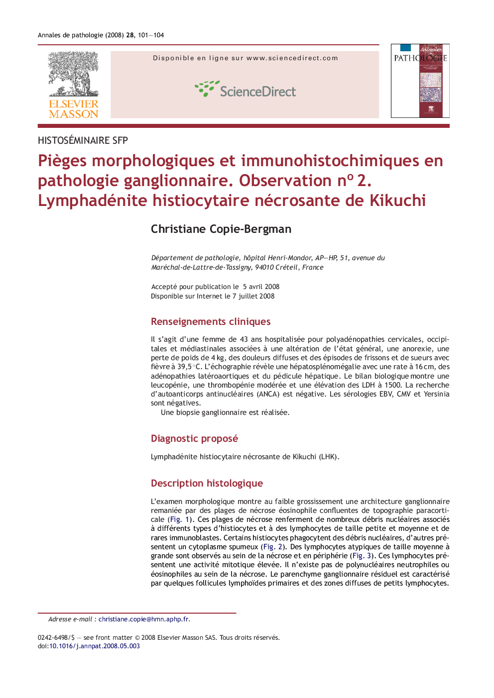 PiÃ¨ges morphologiques et immunohistochimiques en pathologie ganglionnaire. Observation noÂ 2
