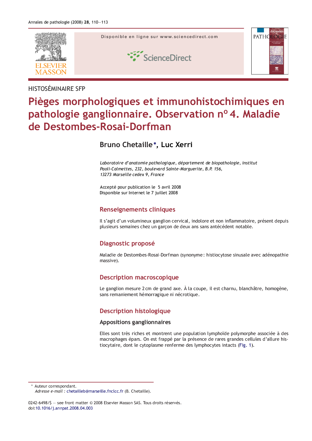 PiÃ¨ges morphologiques et immunohistochimiques en pathologie ganglionnaire. Observation noÂ 4