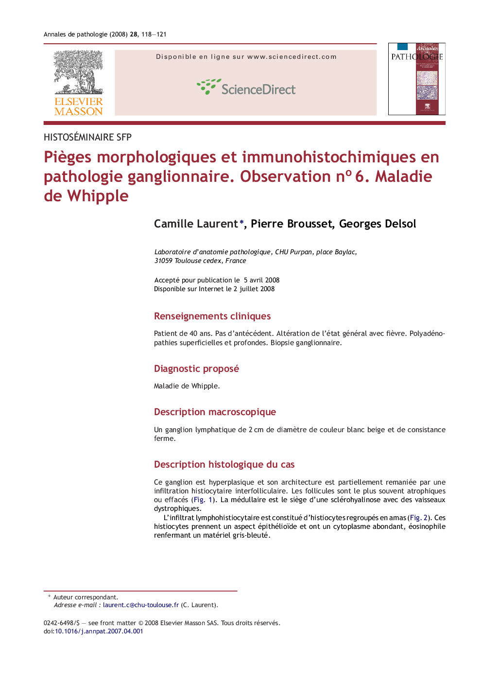 PiÃ¨ges morphologiques et immunohistochimiques en pathologie ganglionnaire. Observation noÂ 6