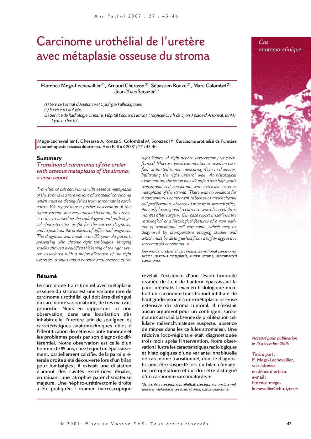 Cas anatomo-cliniqueCarcinome urothélial de l'uretÃ¨re avec métaplasie osseuse du stromaTransitional carcinoma of the ureter with osseous metaplasia of the stroma: a case report