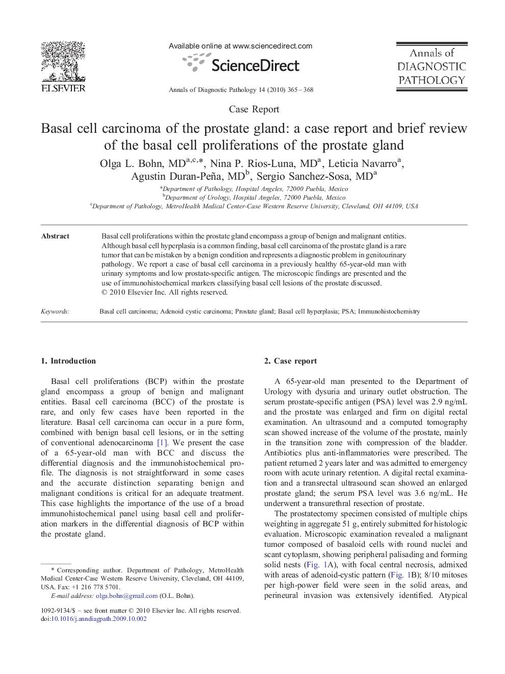 Basal cell carcinoma of the prostate gland: a case report and brief review of the basal cell proliferations of the prostate gland