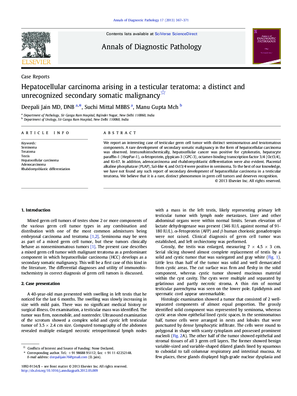 Hepatocellular carcinoma arising in a testicular teratoma: a distinct and unrecognized secondary somatic malignancy 