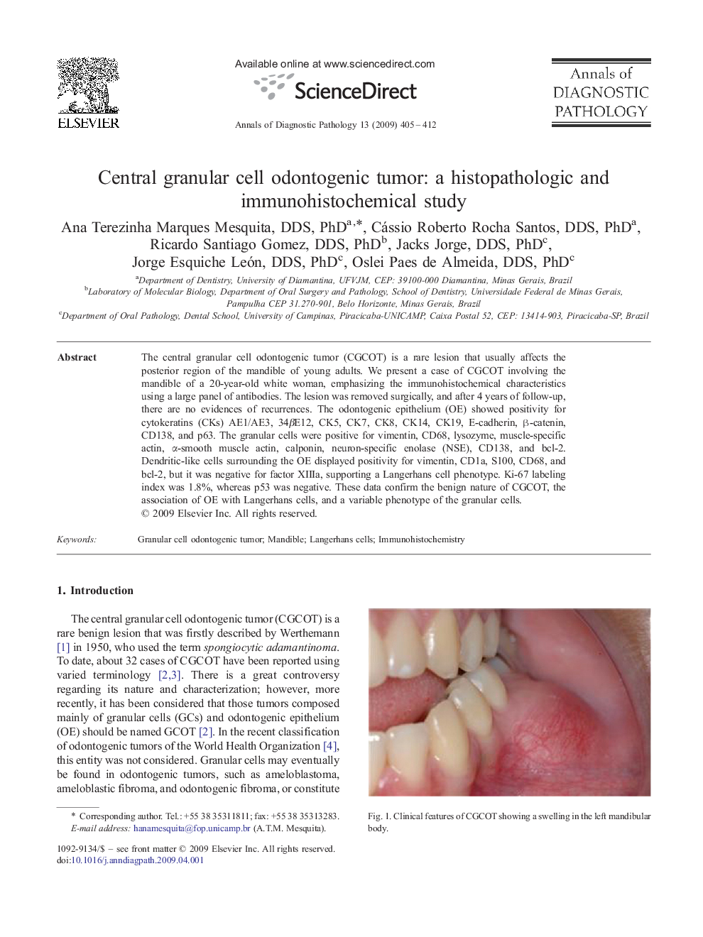 Central granular cell odontogenic tumor: a histopathologic and immunohistochemical study