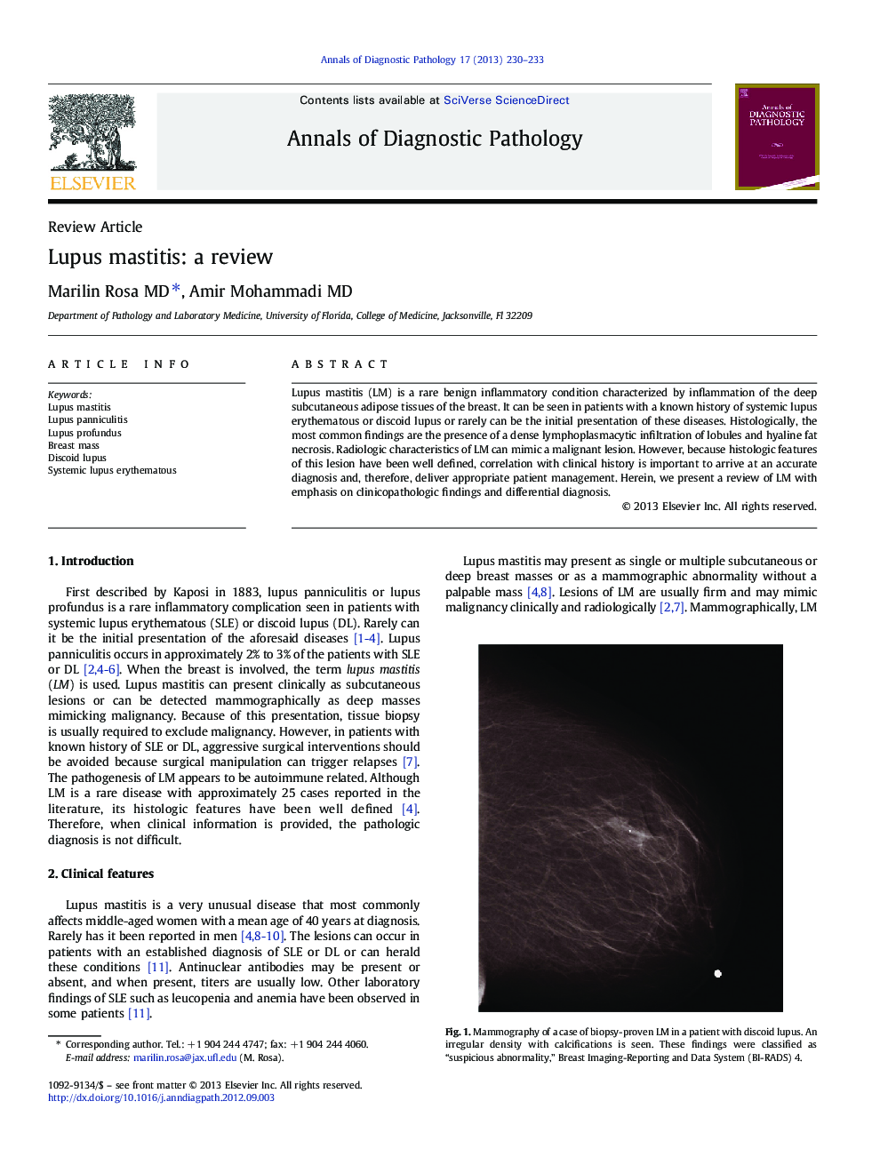 Lupus mastitis: a review