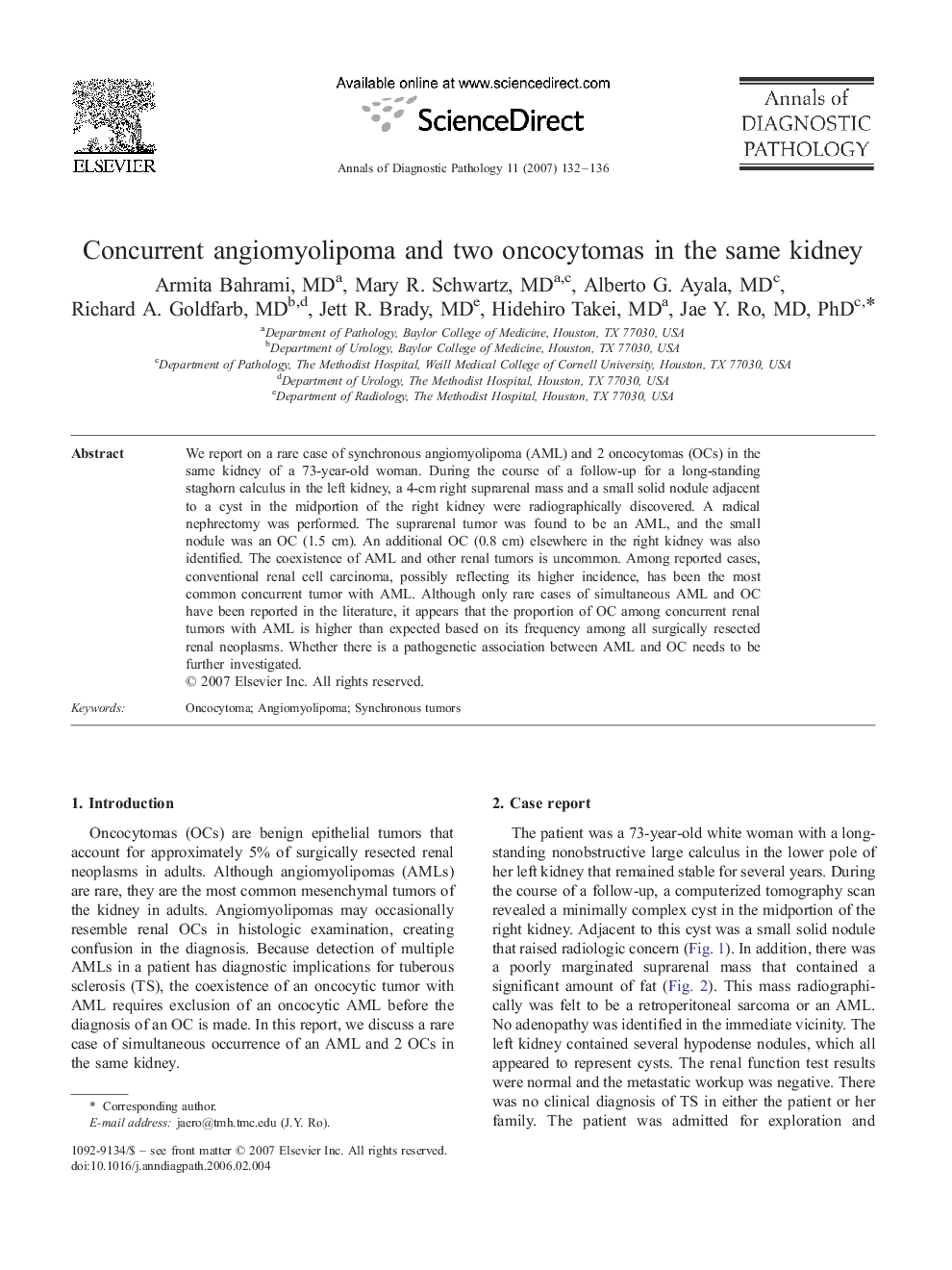 Concurrent angiomyolipoma and two oncocytomas in the same kidney