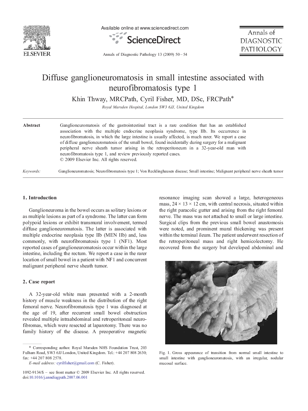 Diffuse ganglioneuromatosis in small intestine associated with neurofibromatosis type 1