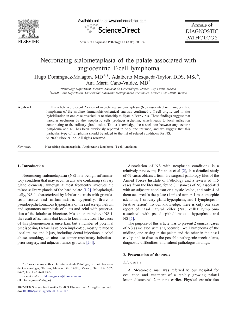 Necrotizing sialometaplasia of the palate associated with angiocentric T-cell lymphoma