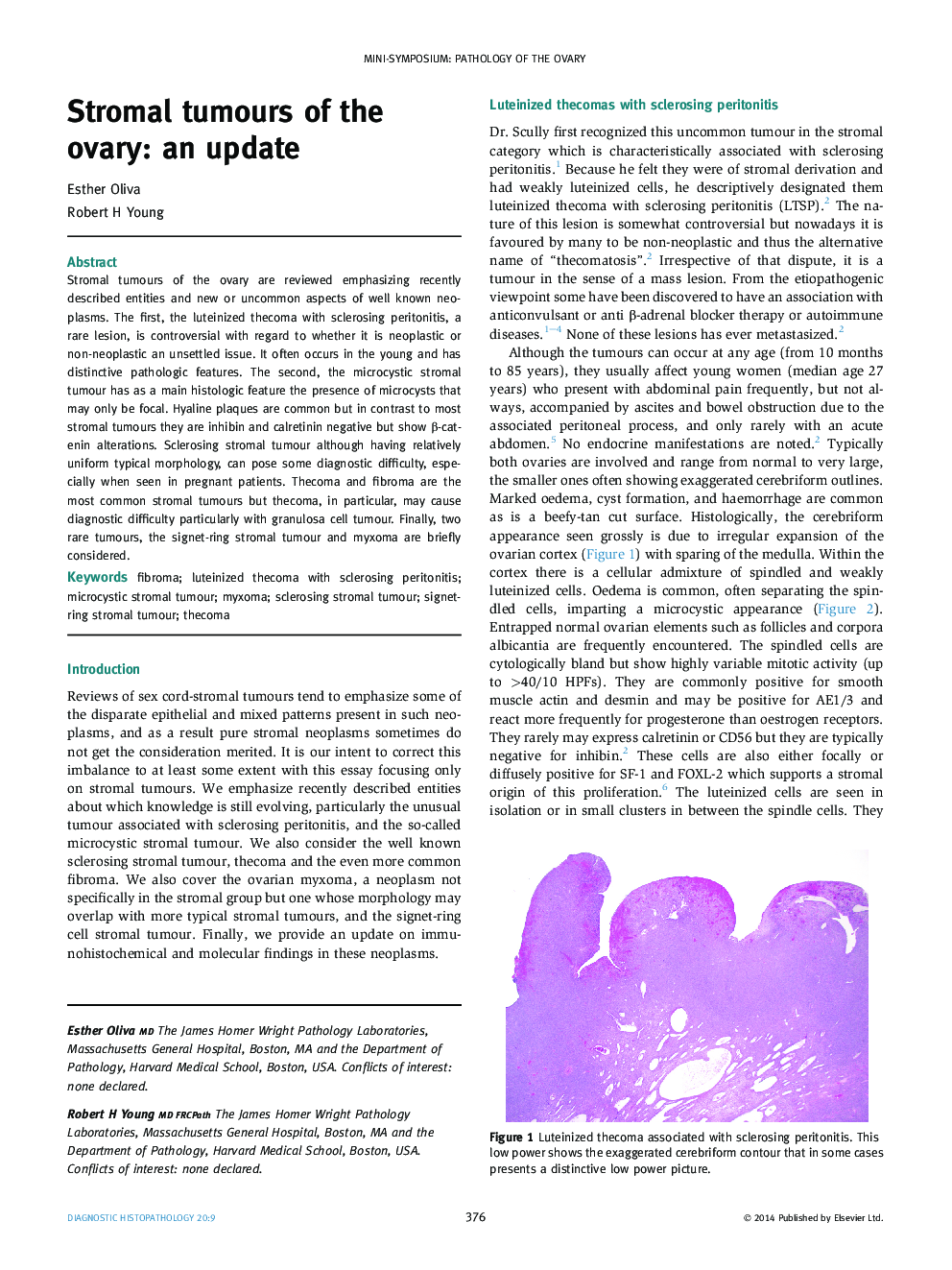 Stromal tumours of the ovary: an update