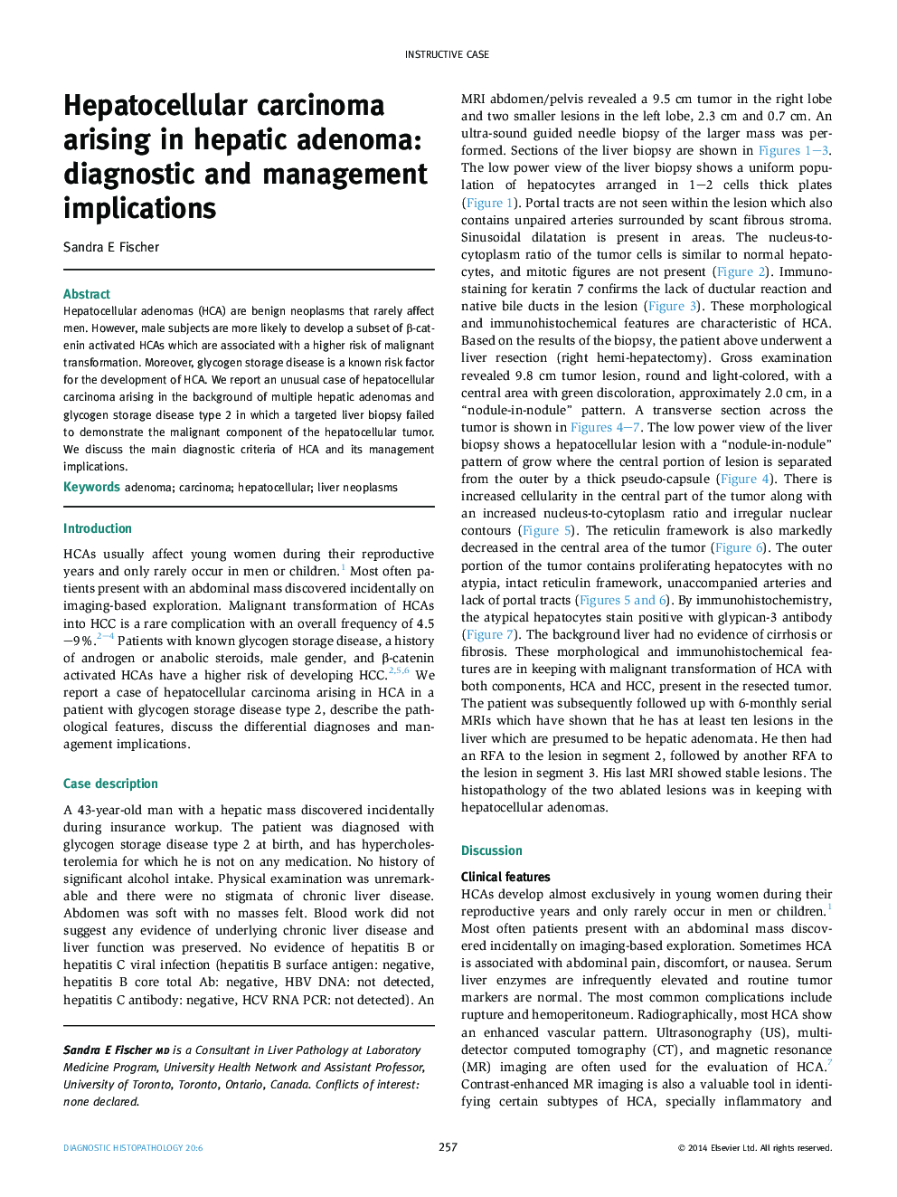 Hepatocellular carcinoma arising in hepatic adenoma: diagnostic and management implications