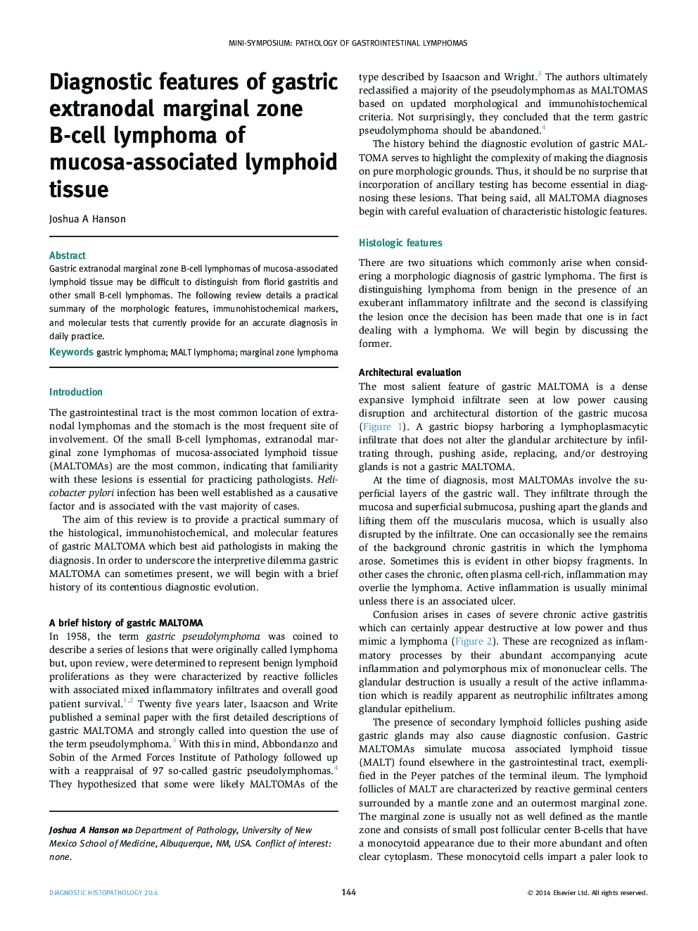 Diagnostic features of gastric extranodal marginal zone B-cell lymphoma of mucosa-associated lymphoid tissue