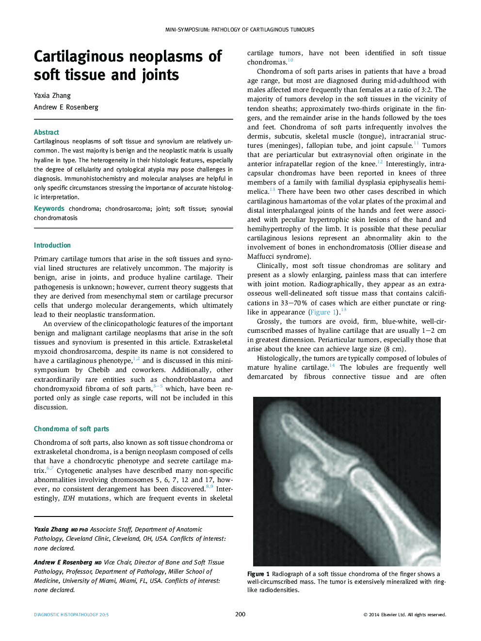 Cartilaginous neoplasms of soft tissue and joints